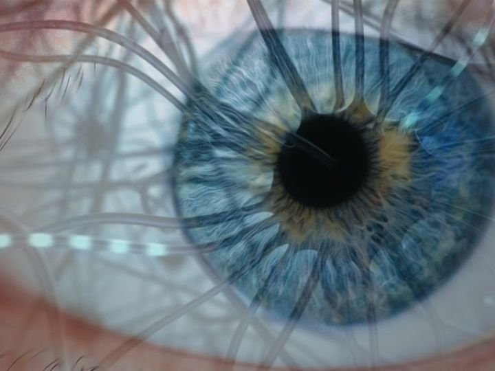 Examining brain through retina
